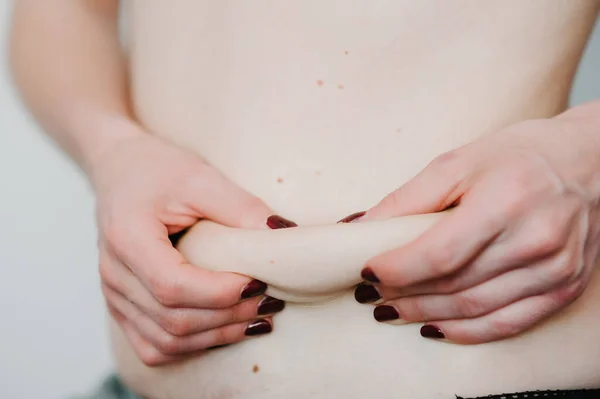 Jovem Segurando Pele Gorda Beliscando Celulite Estômago Para Teste Isolado — Fotografia de Stock