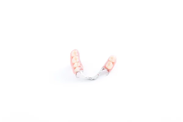 Partial denture,dental prosthetics on a white background — Stock Photo, Image