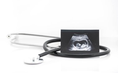 Ultrason kadın gebelik sırasında tıbbi görüntüleri kolaj göster