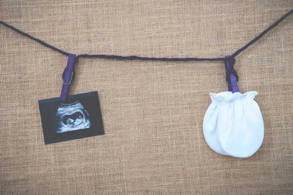 Kolażu obrazów medycznych USG w czasie ciąży kobieta pokazuje płodu w trzecim miesiącu i Baby rękawice z tłem worze — Zdjęcie stockowe
