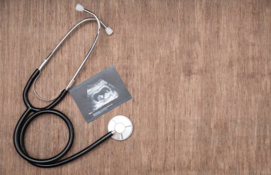 Bebek ultrason resmini ve stetoscope ahşap arka plan üzerinde