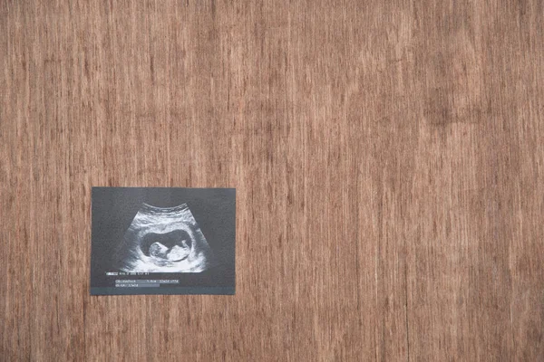 Immagine ad ultrasuoni bambino su sfondo di legno — Foto Stock