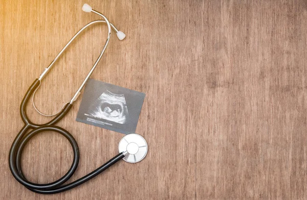 Baby-Ultraschallbild und Stetoskop auf Holzgrund — Stockfoto