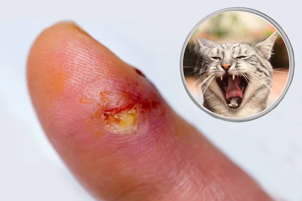 指で猫のかみ傷 — ストック写真