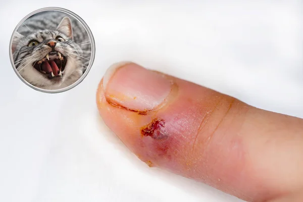 指で猫のかみ傷の傷に感染 — ストック写真