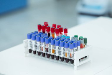 Coronavirus kan testi konsepti. Coronavirus testi için test tüpündeki kan örneğini analiz ediyorum. 2019-nCoV veya COVID-19 testi için kanla tüp.