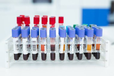 Coronavirus kan testi konsepti. Coronavirus testi için test tüpündeki kan örneğini analiz ediyorum. 2019-nCoV veya COVID-19 testi için kanla tüp.
