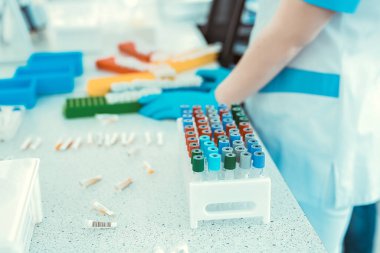 Corona virüsü, 2019-NCoV veya COVID-19. Yeni Coronavirus. Doktor, koronavirüs salgınıyla savaşmaya hazırlanıyor. Aşı ve ilaç arıyor. Sağlık ve tıbbi konsept