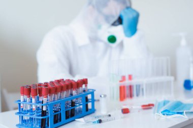 Stresli erkek doktor masasında yorgun oturuyor. Koruyucu giysilerle uzun saatler çalışan orta yaşlı bir erkek doktor. Covid-19 'un ofisinde çok çalışan bir doktorun molaya ihtiyacı var..