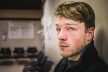 Bekleme odası ve hastane içinde genç bir yetişkin Alerjik reaksiyon sonra kırmızı ve şiş yüz