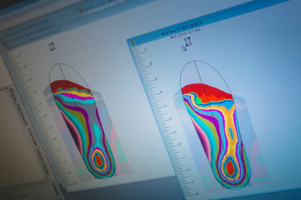 Orthotics and Prosthesis Workshop with a Foot Scan Analysis on a — Stock Photo, Image