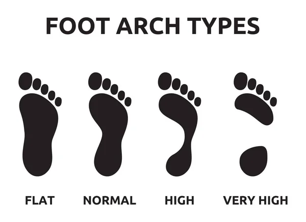 Foot arch types — Stock Vector