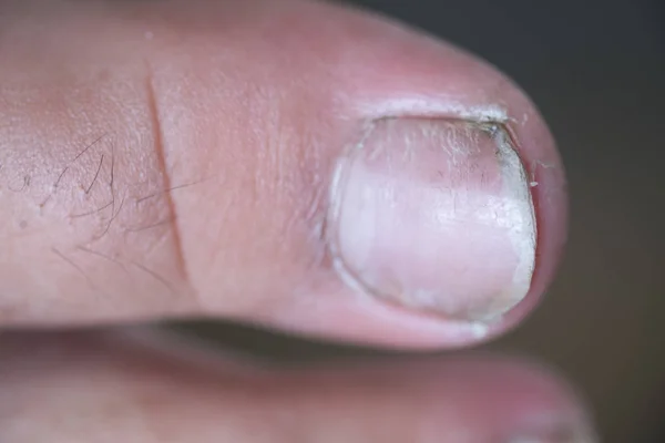 Niños sucios uñas de los dedos. Sucio dedo uñas . — Foto de Stock