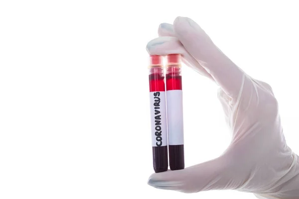 Temiz Bir Test Tüpü Yeni Bir Koronavirüsün Kan Tüpü Ile — Stok fotoğraf