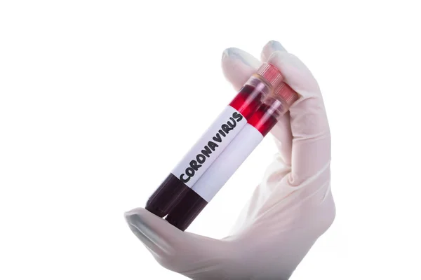 Temiz Bir Test Tüpü Yeni Bir Koronavirüsün Kan Tüpü Ile — Stok fotoğraf