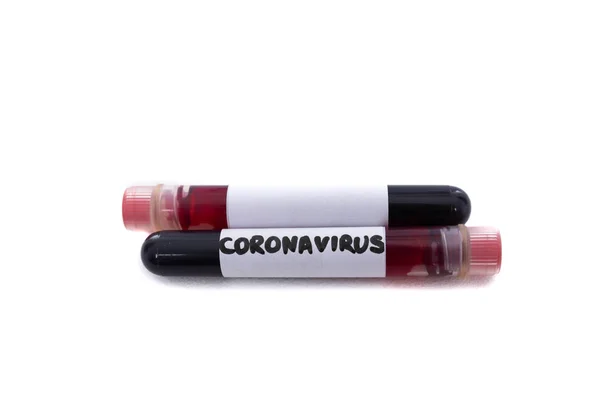 Dos Viales Sangre Sobre Fondo Blanco Epidemia Coronavirus — Foto de Stock