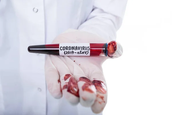 Eldivene Kan Bulaşmış Bir Test Tüpünün Yakın Çekimi Koronavirüs Salgını — Stok fotoğraf