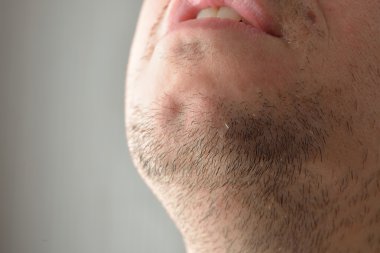 Sakalını bir çukur ile genç bir adamın resmi. Yarım yüz par