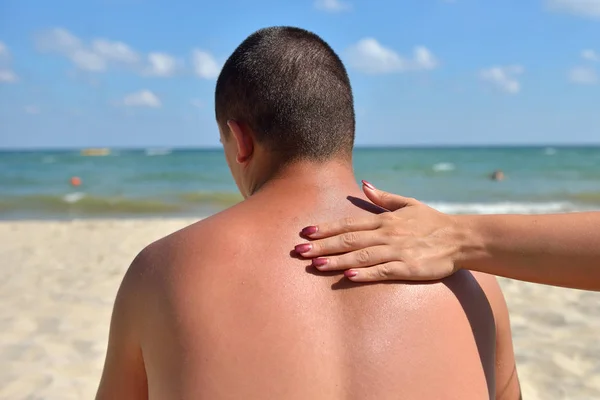 Mano de una mujer que aplica crema solar en una espalda masculina con protector solar — Foto de Stock