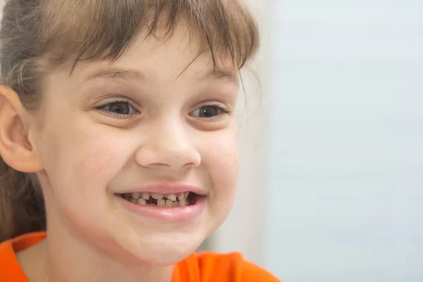 Niña de siete años con una sonrisa mira sus curvas dientes de bebé —  Fotos de Stock