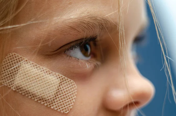 Ένα Ιατρικό Τσιρότο Είναι Κολλημένο Κάτω Από Μάτι Του Κοριτσιού — Φωτογραφία Αρχείου