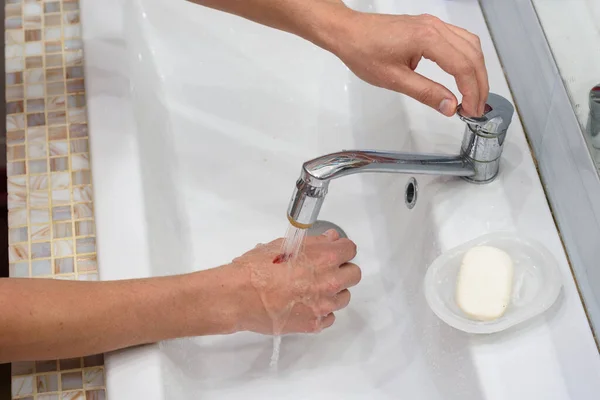 Hombre Lava Una Herida Mano Bajo Chorro Agua Lavabo — Foto de Stock