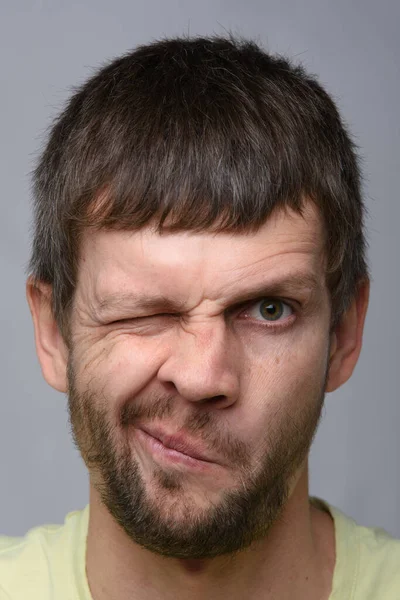 Close Retrato Homem Aparência Europeia Que Apertou Olho Esquerdo Firmemente — Fotografia de Stock