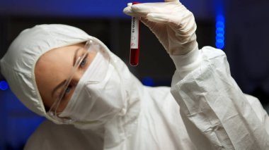 COVID-19 için tüp içinde bilim adamı test örneği