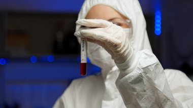 COVID-19 için tüp içinde bilim adamı test örneği