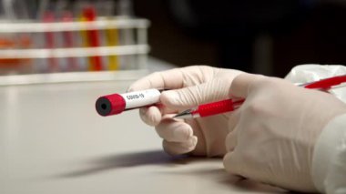 COVID-19 test tüpünü işaretleyen bilim adamı