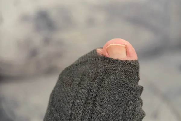 Большой палец - отверстие в носке — стоковое фото