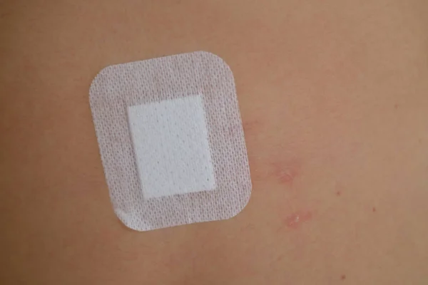 Sticking plaster on wound — Stock Photo, Image