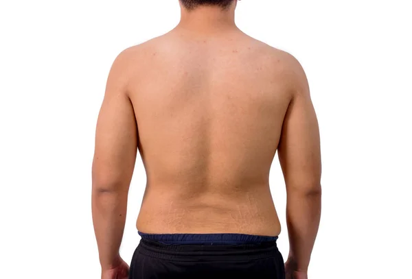 Naked back of fat boy white background — Stok Foto