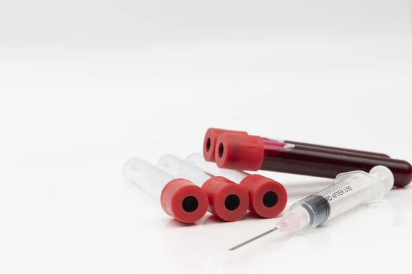 Medical Equipment Contain Syringe Plastic Test Tube Blood Sample Laboratory — Stock Photo, Image