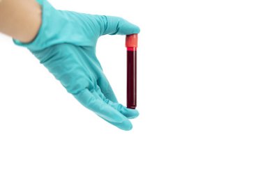 Beyaz arka planda izole edilmiş ve seçici odaklanmış kan tüpü tutan yeşil lastik eldivenli el.