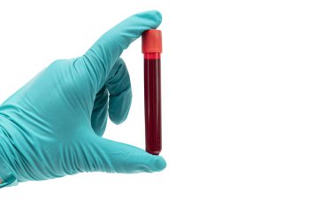 Beyaz arka planda izole edilmiş ve seçici odaklanmış kan tüpü tutan yeşil lastik eldivenli el.