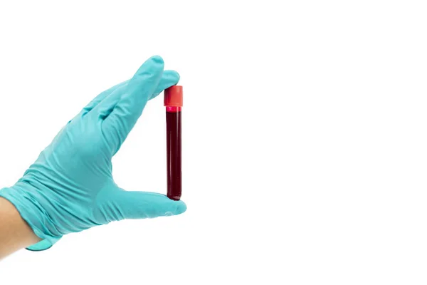 Hand Safety Green Rubber Glove Holding Blood Tube Blood Isolated — Stock Photo, Image