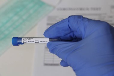 Coronavirus 'un belirlenmesi için laboratuvar testi. Kavram. Doktor analiz için bir test tüpü tutuyor. Test tüpünde pozitif ve negatif olduğu yazıyor. Evet. Masada testleri yaptırmak için rıza var..