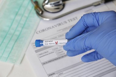Kavramsal fotoğrafçılık, koronavirüs testi. Elinde hastanın numunesinin olduğu bir test tüpü var. Analizin sonucu olumsuzdur. Tadı Coronavirus COVID-19 için negatif çıktı..
