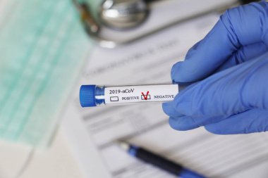 Kavramsal fotoğrafçılık, koronavirüs testi. Elinde hastanın numunesinin olduğu bir test tüpü var. Analizin sonucu olumsuzdur. Tadı Coronavirus COVID-19 için negatif çıktı..