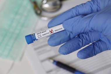 Kavramsal fotoğrafçılık, koronavirüs testi. Elinde hastanın numunesinin olduğu bir test tüpü var. Analizin sonucu olumsuzdur. Tadı Coronavirus COVID-19 için negatif çıktı..