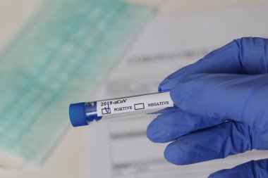 Kavramsal fotoğrafçılık, koronavirüs testi. Elinde hastanın numunesinin olduğu bir test tüpü var. Analizin sonucu pozitiftir. Tadı Coronavirus COVID-19 için pozitif çıktı..