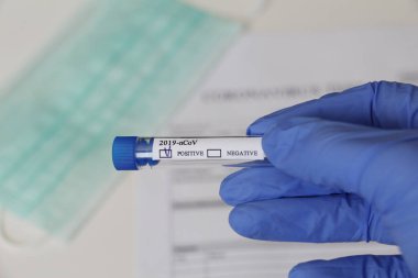 Kavramsal fotoğrafçılık, koronavirüs testi. Elinde hastanın numunesinin olduğu bir test tüpü var. Analizin sonucu pozitiftir. Tadı Coronavirus COVID-19 için pozitif çıktı..