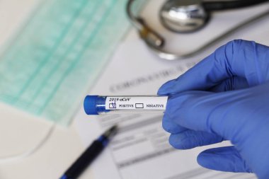 Kavramsal fotoğrafçılık, koronavirüs testi. Elinde hastanın numunesinin olduğu bir test tüpü var. Analizin sonucu pozitiftir. Tadı Coronavirus COVID-19 için pozitif çıktı..