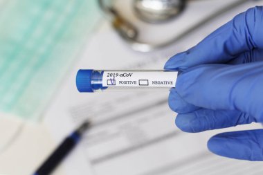 Kavramsal fotoğrafçılık, koronavirüs testi. Elinde hastanın numunesinin olduğu bir test tüpü var. Analizin sonucu pozitiftir. Tadı Coronavirus COVID-19 için pozitif çıktı..