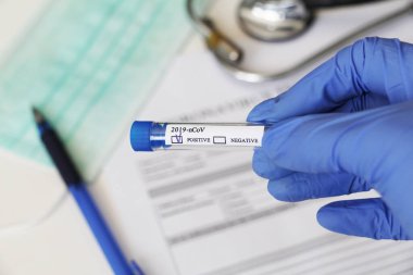 Kavramsal fotoğrafçılık, koronavirüs testi. Elinde hastanın numunesinin olduğu bir test tüpü var. Analizin sonucu pozitiftir. Tadı Coronavirus COVID-19 için pozitif çıktı..