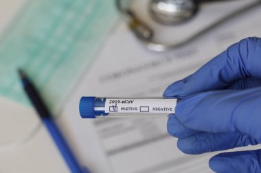 Kavramsal fotoğrafçılık, koronavirüs testi. Elinde hastanın numunesinin olduğu bir test tüpü var. Analizin sonucu pozitiftir. Tadı Coronavirus COVID-19 için pozitif çıktı..