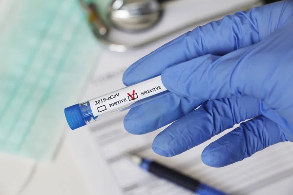 Conceptual Photography Testing Coronavirus Hand Test Tube Sample Patient Result — Stock Photo, Image
