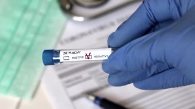 Kavramsal fotoğrafçılık, koronavirüs testi. Elinde hastanın numunesinin olduğu bir test tüpü var. Analizin sonucu olumsuzdur. Tadı koronavirüs için negatif çıktı (COVID-19).