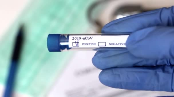 Εννοιολογική Φωτογραφία Δοκιμή Για Coronavirus Στο Χέρι Είναι Ένας Δοκιμαστικός — Αρχείο Βίντεο